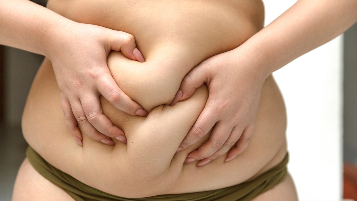 Slimtox Diet vs. Bariatric Surgery: Why Choose the Natural Path - SLIMTOX